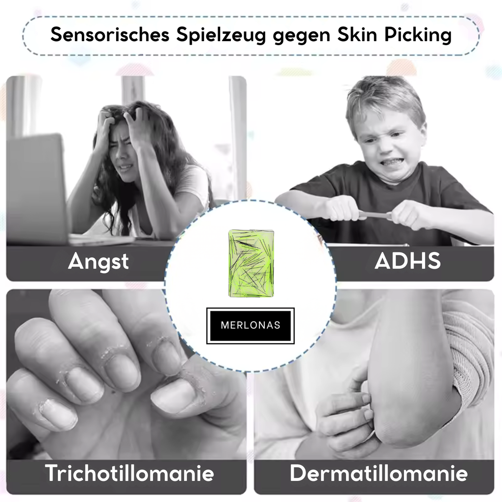 Zupfling™ – Dein neuer Lieblingsbegleiter gegen Stress